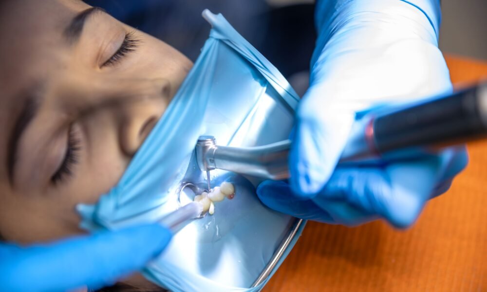 Root canal