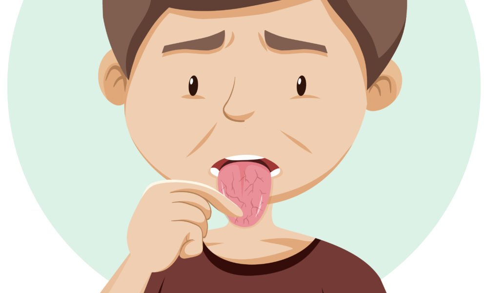 Dry Mouth tips