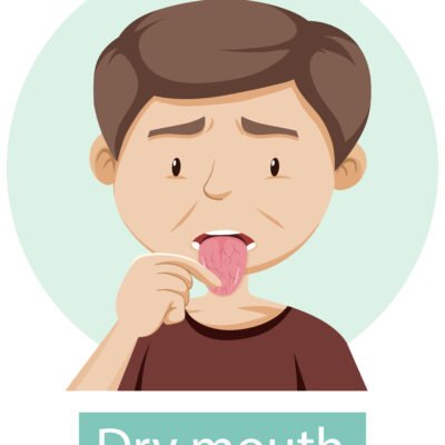 Dry Mouth tips