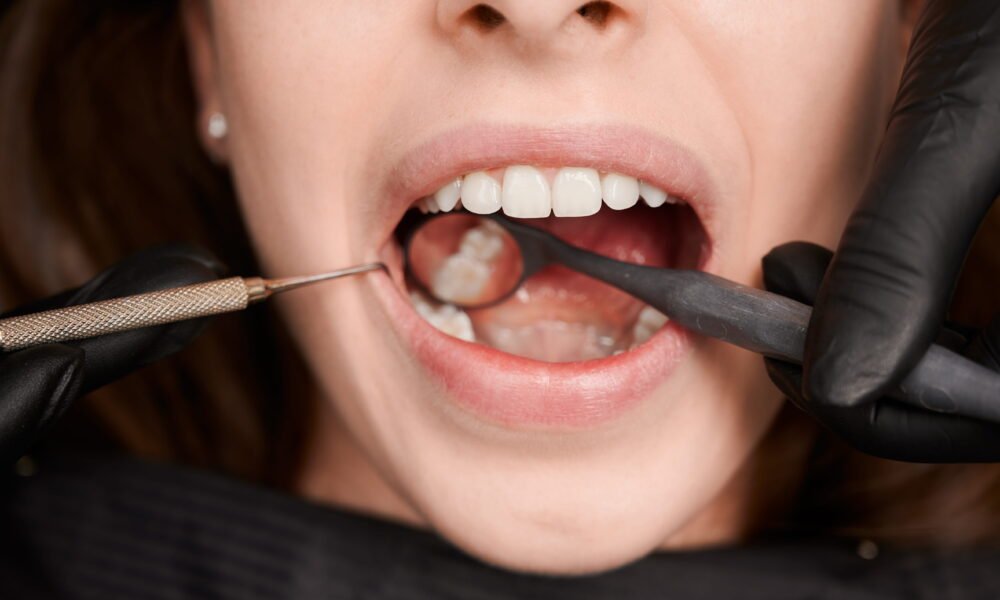 Front Tooth Crown Procedure