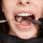 Front Tooth Crown Procedure