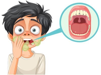 What Causes Bacteria to Build Up in Your Mouth