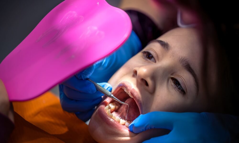 How Do Dental Sealants Actually Work Inside the Mouth
