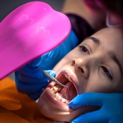 How Do Dental Sealants Actually Work Inside the Mouth