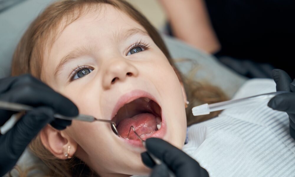 stainless steel pediatric crowns
