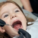 stainless steel pediatric crowns