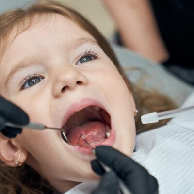 stainless steel pediatric crowns